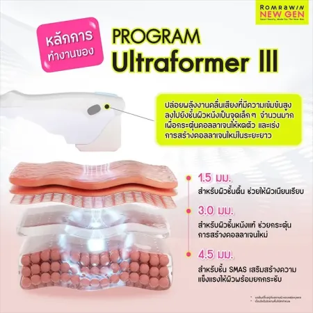 เจาะลึกหลักการทำงานและรีวิวผลลัพธ์การยกกระชับผิวหน้าด้วยโปรแกรม Ultraformer III รมย์รวินท์คลินิก