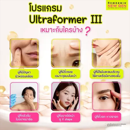 เช็กคุณสมบัติผู้ที่เหมาะเข้ารับบริการรักษาผิวพรรณด้วยโปรแกรม Ultraformer III รมย์รวินท์คลินิก