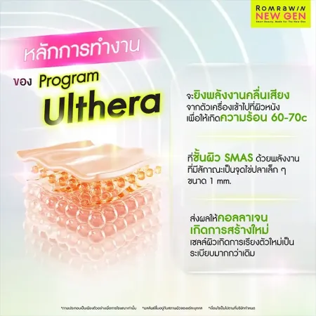 อัลเทอร่า