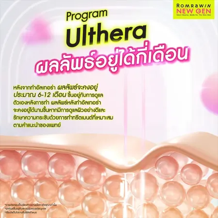 อัลเทอร่า