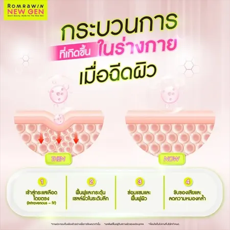 ฉีดผิว