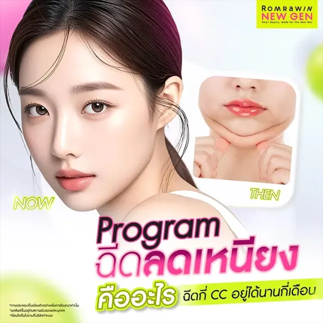 ฉีดแฟตเหนียง คืออะไร กี่ CC อยู่ได้กี่เดือน ข้อห้ามอย่างไร