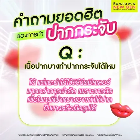 ปากกระจับ