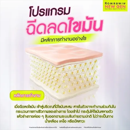 ฉีดแฟต