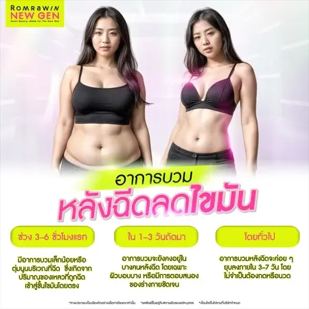 ฉีดแฟต