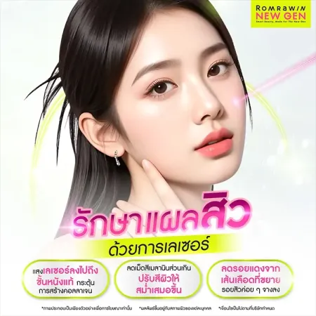 รักษาแผลสิว