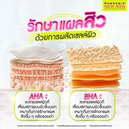 รักษาแผลสิว