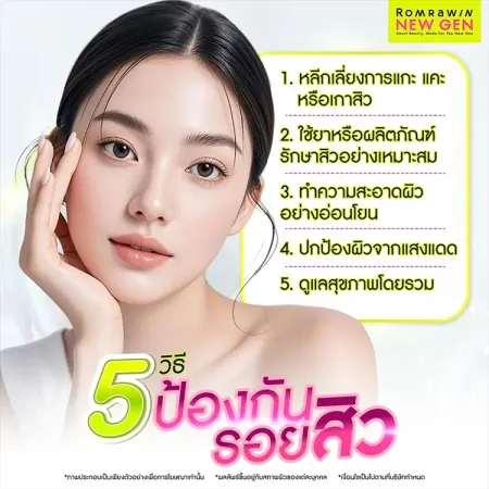 รักษาแผลสิว