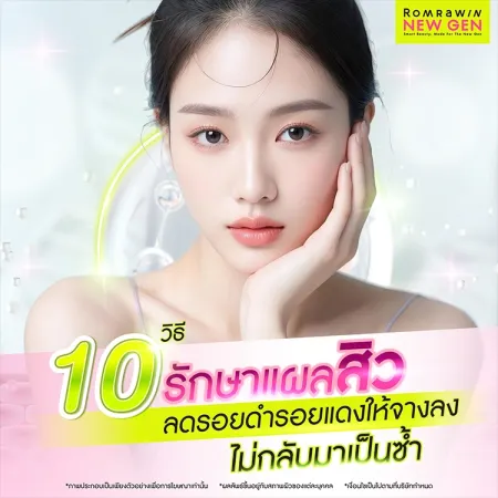 10 วิธีรักษาแผลสิว ลดรอยดำรอยแดงให้จางลง ผิวกลับมาเรียบเนียน