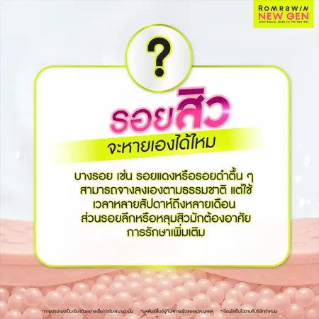 รักษาแผลสิว