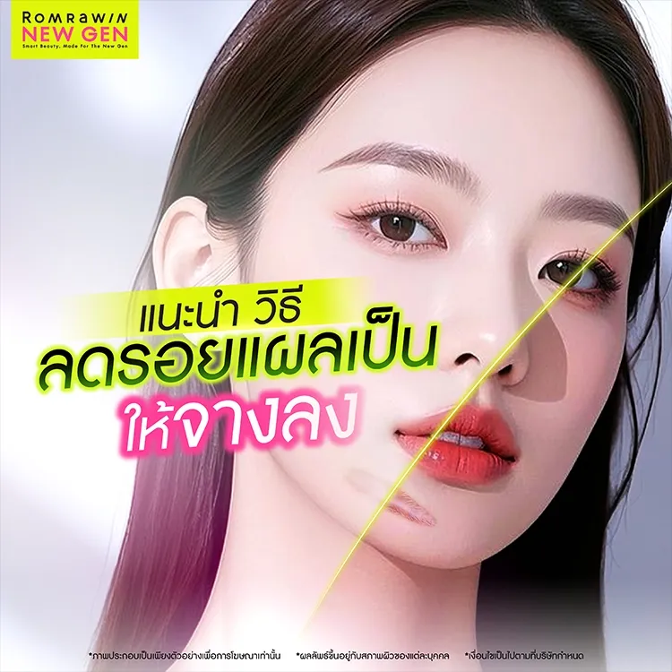 13 วิธีลดรอยแผลเป็นให้ดูจางลง รักษาอย่างไรให้ผิวกลับมาเรียบเนียน