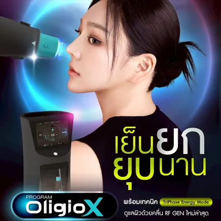 Oligio X คืออะไร ต่างจากรุ่นเดิมอย่างไร เหมาะกับใคร