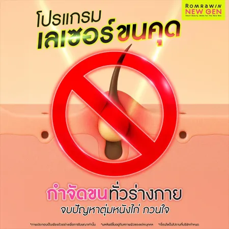 เลเซอร์ขนคุด คืออะไร มีกี่แบบแตกต่างกันอย่างไรบ้าง