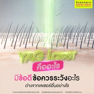 YAG Laser คืออะไร แตกต่างจากเครื่องเลเซอร์อื่นอย่างไร เหมาะกับใคร