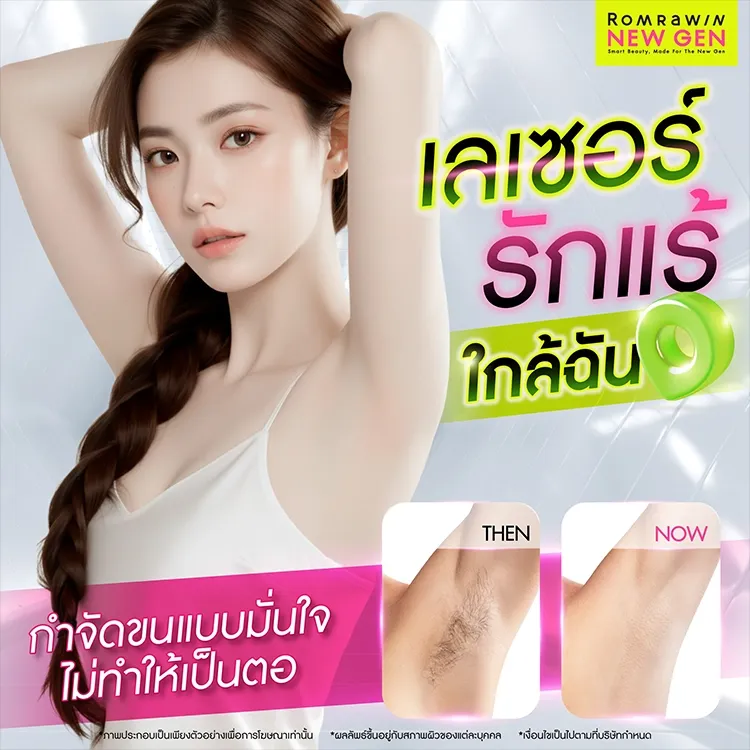 เลเซอร์รักแร้ใกล้ฉัน กำจัดขนแบบมั่นใจ ไม่ทำให้เป็นตอ