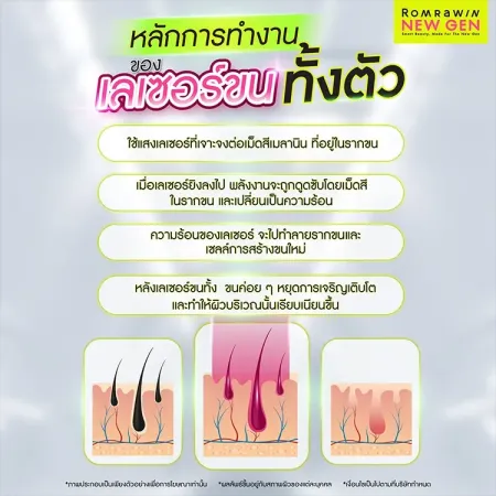 เลเซอร์ขนทั้งตัว