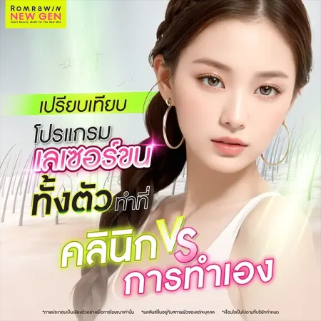 เลเซอร์ขนทั้งตัว
