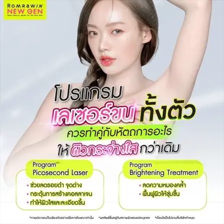เลเซอร์ขนทั้งตัว