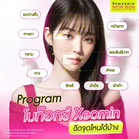 โบท็อกซ์ Xeomin