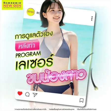 เลเซอร์ขนจิมิ