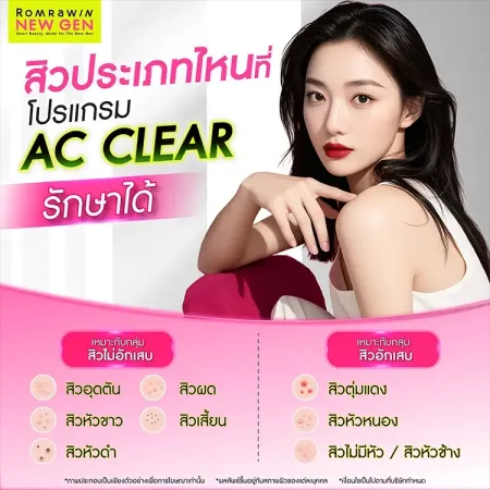 AC Clear สิวประเภทไหนรักษาได้ ภาพอธิบายกลุ่มสิวอักเสบและสิวไม่อักเสบ