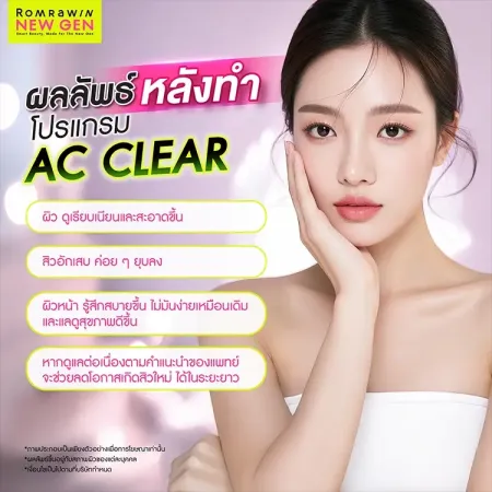 AC Clear ผลลัพธ์เคลียร์สิว ภาพอธิบายความเปลี่ยนแปลงของผิวหน้าหลังเข้าโปรแกรม
