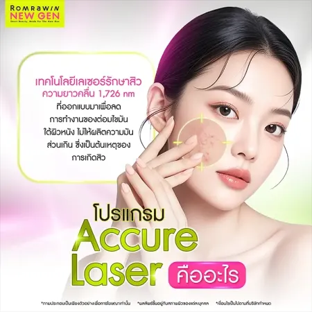 Accure Laser