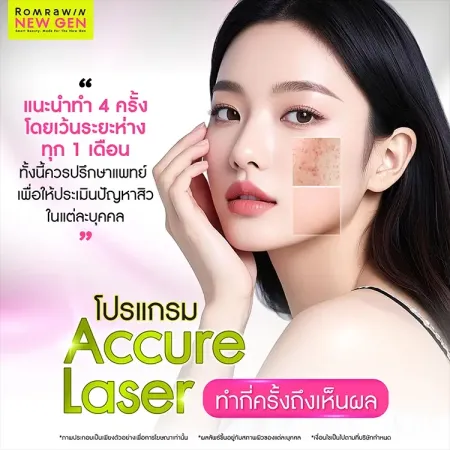 Accure Laser