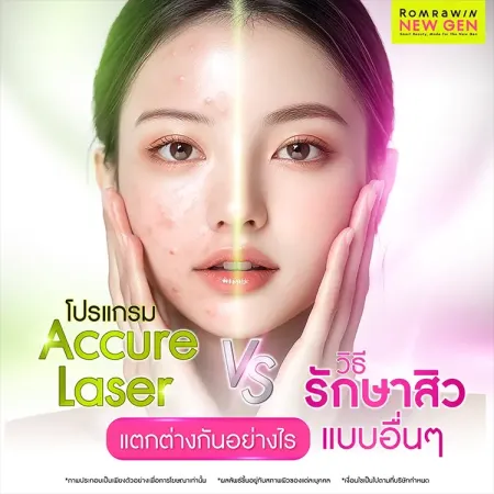 Accure Laser