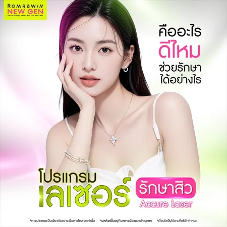 Accure Laser คืออะไร เลเซอร์สิวดีไหม รักษาได้อย่างไร
