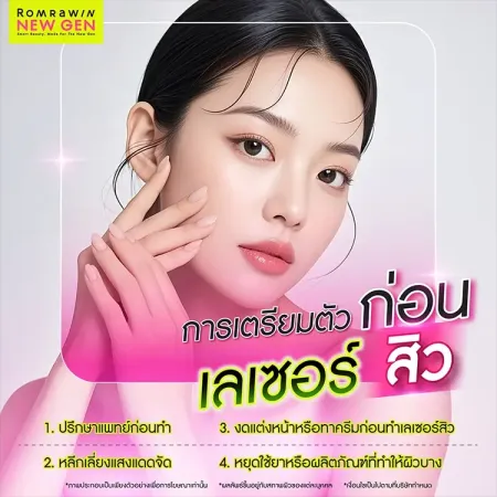 เลเซอร์สิว