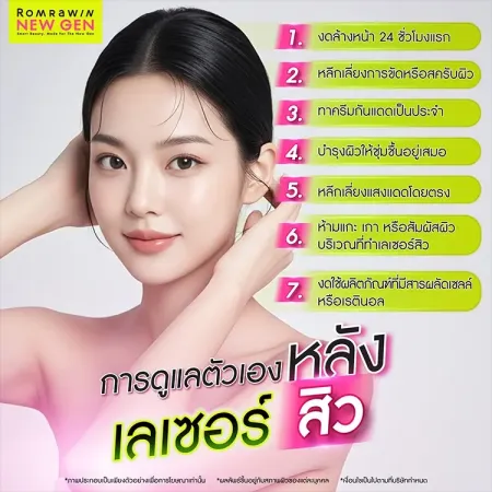 เลเซอร์สิว