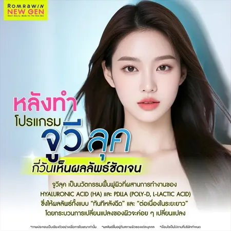 จูวีลุค