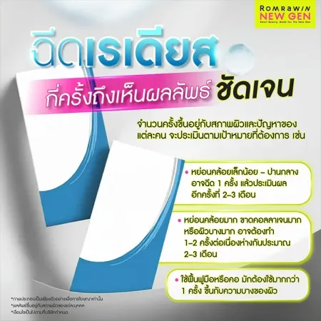 เรเดียส