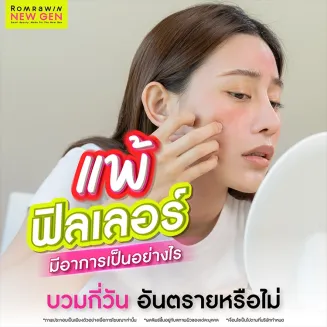 แพ้ฟิลเลอร์ มีอาการเป็นอย่างไร บวมกี่วัน อันตรายหรือไม่