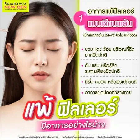 แพ้ฟิลเลอร์