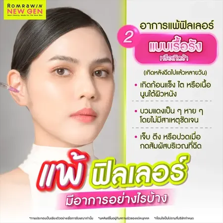 แพ้ฟิลเลอร์