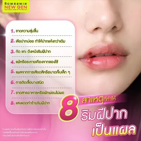 ริมฝีปากเป็นแผล