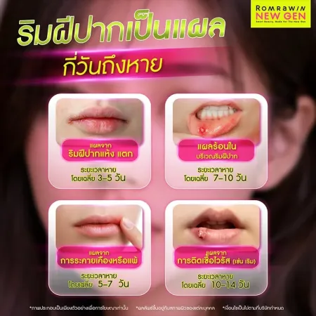 ริมฝีปากเป็นแผล