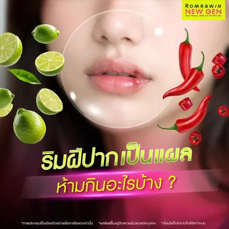 ริมฝีปากเป็นแผล
