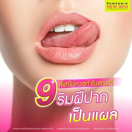 ริมฝีปากเป็นแผล