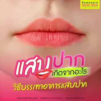 อาการแสบปาก สาเหตุเกิดจากอะไร แก้ไขอย่างไร กี่วันหาย