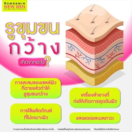 รูขุมขนกว้าง