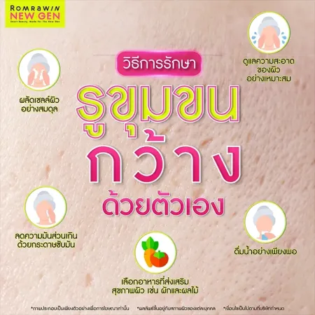 รูขุมขนกว้าง
