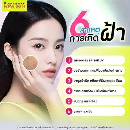 Meso Melasma