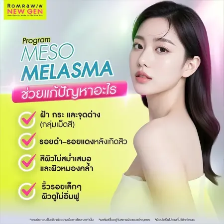 Meso Melasma