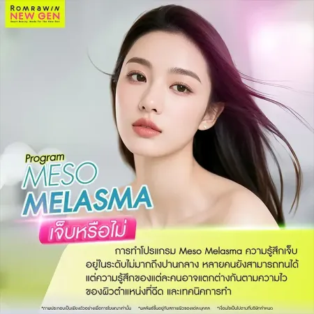 Meso Melasma