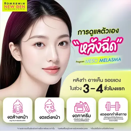 Meso Melasma