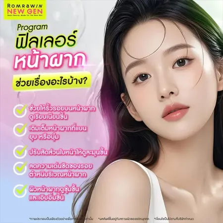 ฉีดฟิลเลอร์หน้าผาก