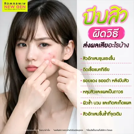 บีบสิว